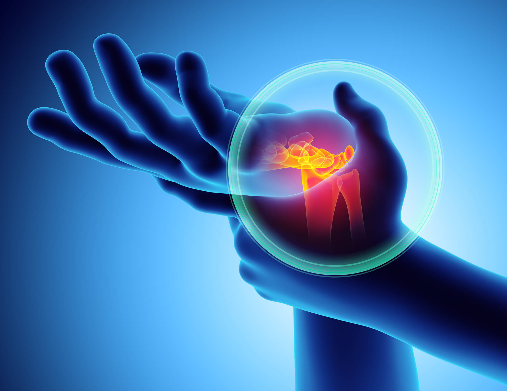 How to Reduce Carpal Tunnel Syndrome Through Diet and Healthy Habits